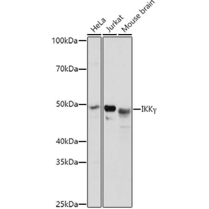 IKKGamma Rabbit Polyclonal Antibody