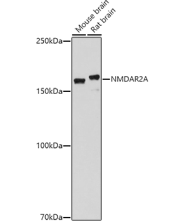 NMDAR2A Rabbit Polyclonal Antibody