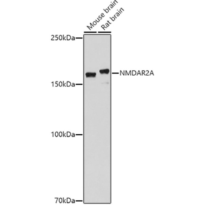 NMDAR2A Rabbit Polyclonal Antibody