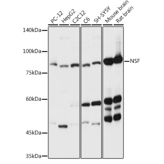 NSF Rabbit Polyclonal Antibody