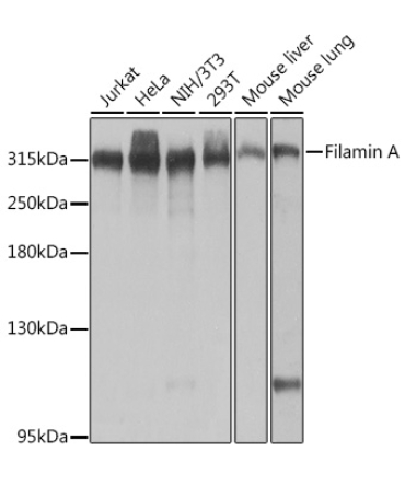 Filamin A Rabbit Polyclonal Antibody