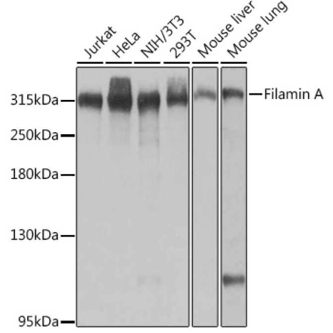 Filamin A Rabbit Polyclonal Antibody