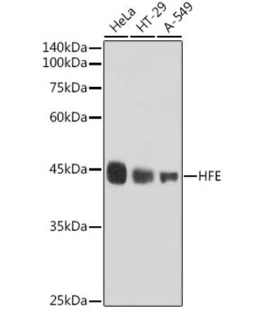 HFE Rabbit Monoclonal Antibody