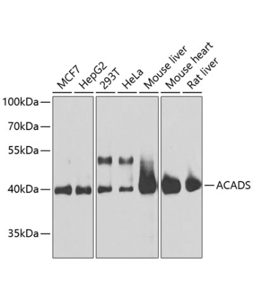 ACADS Rabbit Polyclonal Antibody