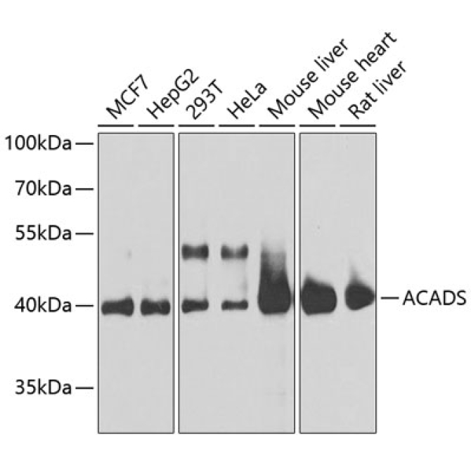 ACADS Rabbit Polyclonal Antibody