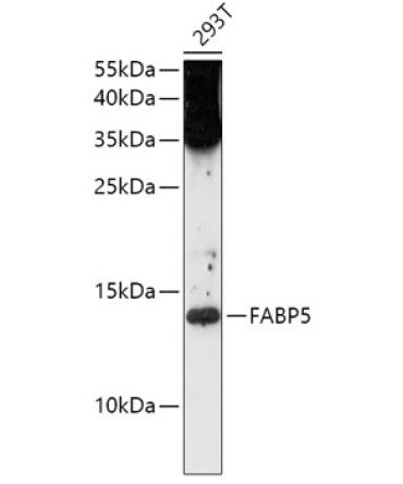 FABP5 Rabbit Polyclonal Antibody