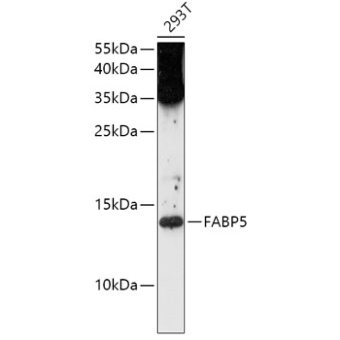 FABP5 Rabbit Polyclonal Antibody