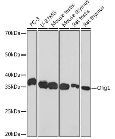 Olig1 Rabbit Monoclonal Antibody