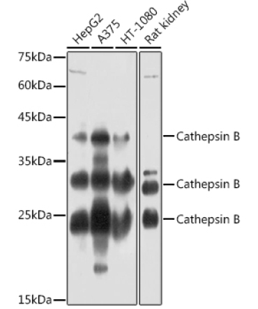 Cathepsin B Rabbit Polyclonal Antibody