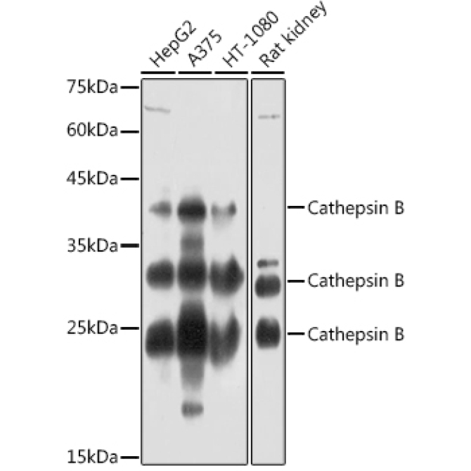 Cathepsin B Rabbit Polyclonal Antibody