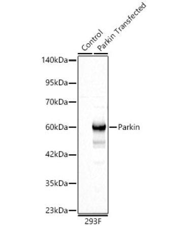 Human Parkin Rabbit Polyclonal Antibody