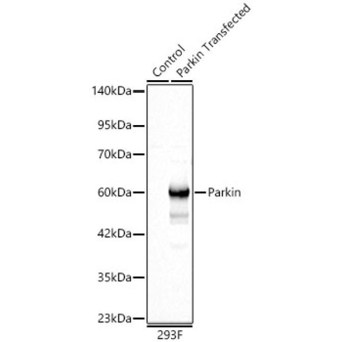 Human Parkin Rabbit Polyclonal Antibody