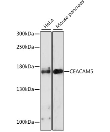 CEACAM5 Rabbit Polyclonal Antibody