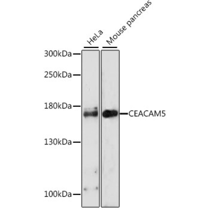 CEACAM5 Rabbit Polyclonal Antibody