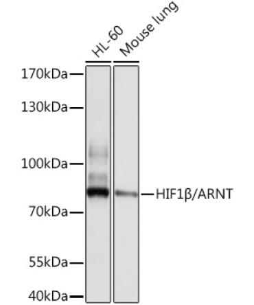 HIF1Beta/ARNT Rabbit Polyclonal Antibody