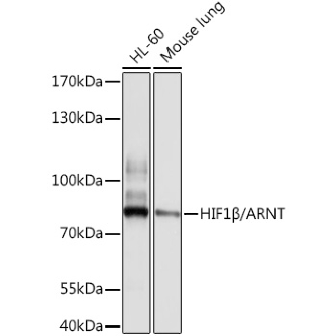 HIF1Beta/ARNT Rabbit Polyclonal Antibody