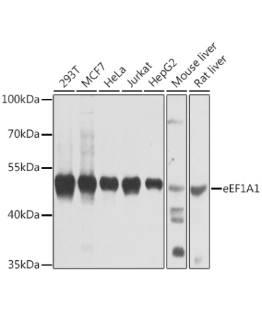 eEF1A1 Rabbit Polyclonal Antibody