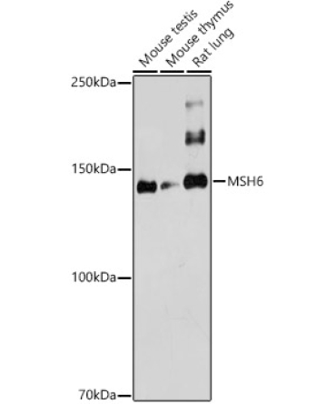 MSH6 Rabbit Polyclonal Antibody
