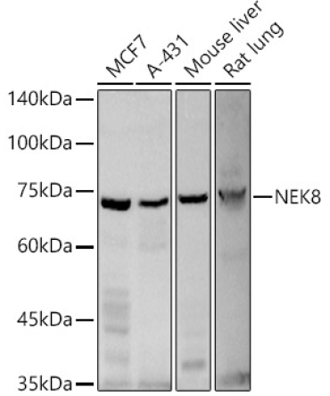 NEK8 Rabbit Polyclonal Antibody