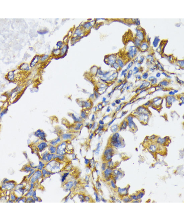 Grp94 Rabbit Polyclonal Antibody