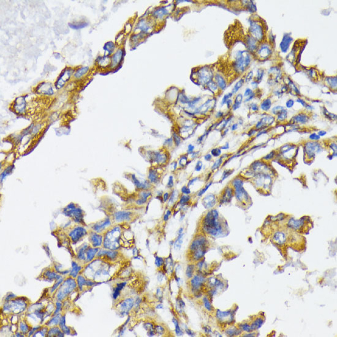 Grp94 Rabbit Polyclonal Antibody