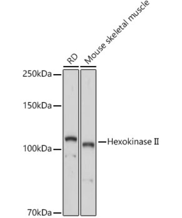Hexokinase II Rabbit Polyclonal Antibody