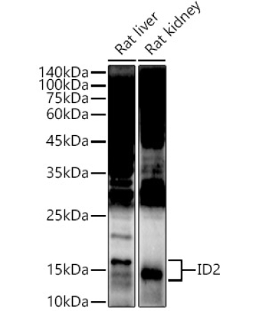 ID2 Rabbit Polyclonal Antibody