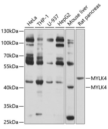 MYLK4 Rabbit Polyclonal Antibody