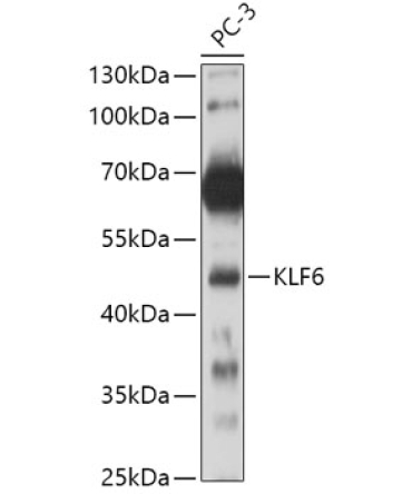 KLF6 Rabbit Polyclonal Antibody