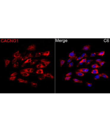 CACNG1 Rabbit Polyclonal Antibody