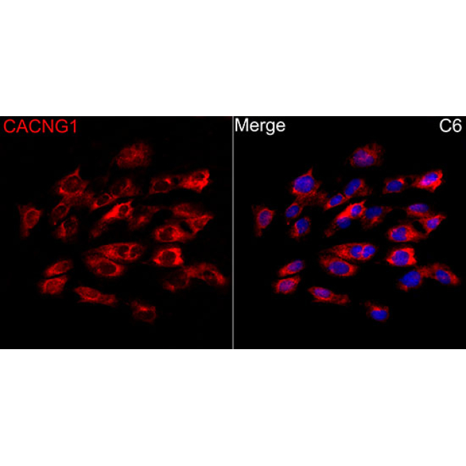 CACNG1 Rabbit Polyclonal Antibody
