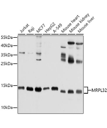 MRPL32 Rabbit Polyclonal Antibody