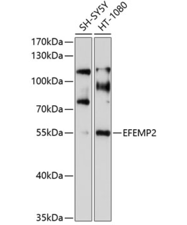 EFEMP2 Rabbit Polyclonal Antibody