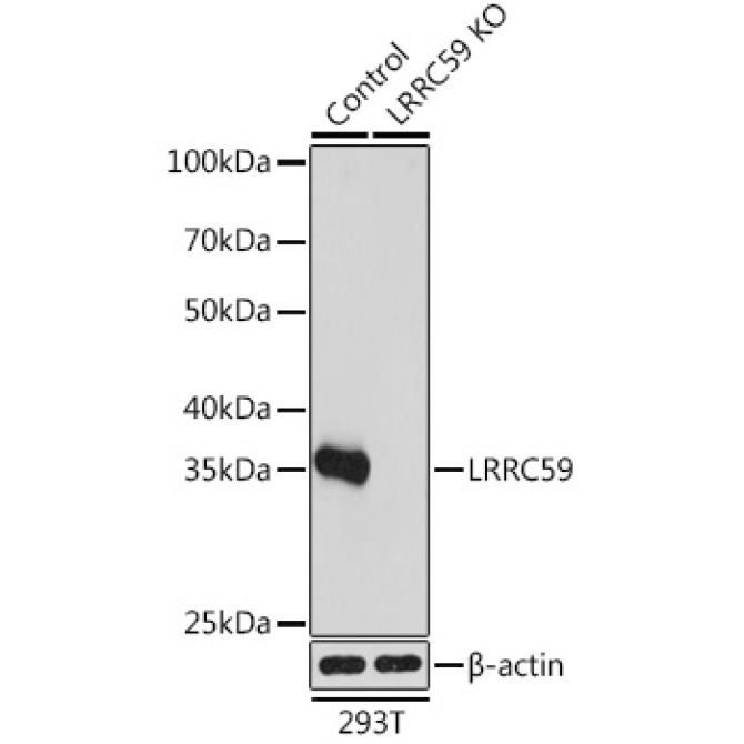 LRRC59 Rabbit Polyclonal Antibody [KO Validated]