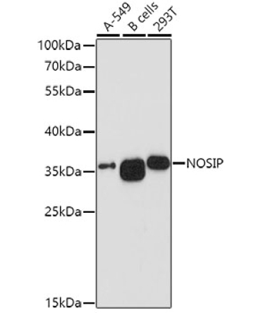 NOSIP Rabbit Polyclonal Antibody
