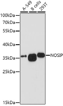 NOSIP Rabbit Polyclonal Antibody