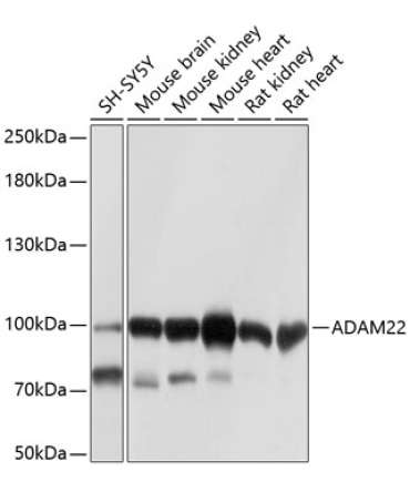 ADAM22 Rabbit Polyclonal Antibody