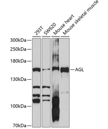 AGL Rabbit Polyclonal Antibody