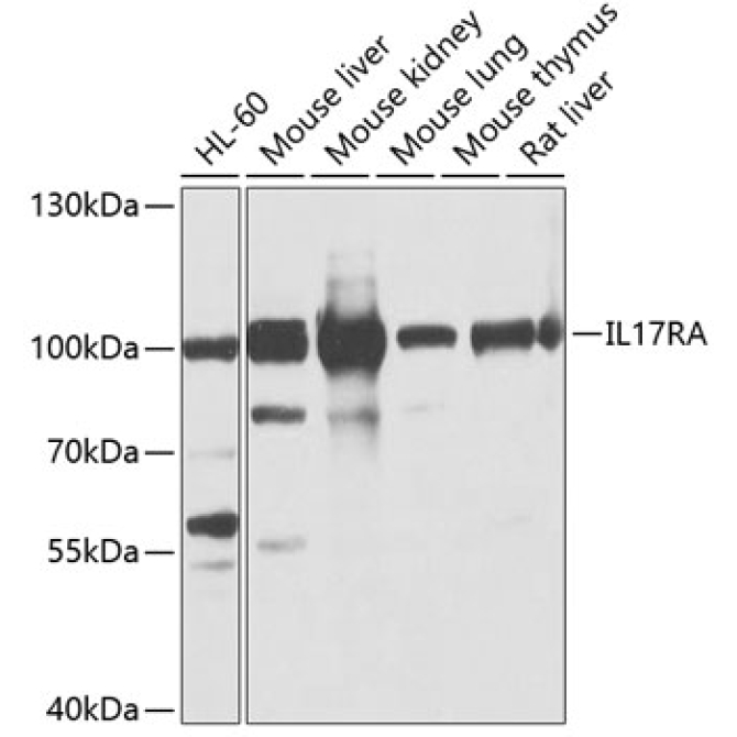 IL17RA Rabbit Polyclonal Antibody