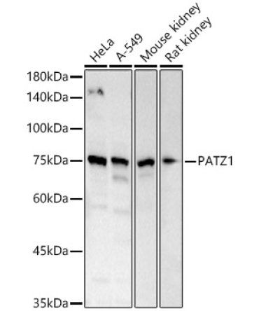 PATZ1 Rabbit Polyclonal Antibody