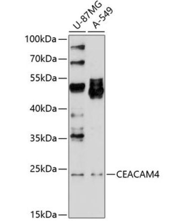 CEACAM4 Rabbit Polyclonal Antibody