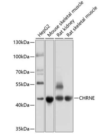 CHRNE Rabbit Polyclonal Antibody