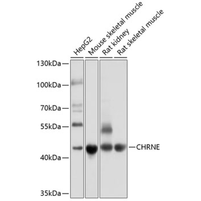 CHRNE Rabbit Polyclonal Antibody