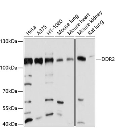 DDR2 Rabbit Polyclonal Antibody