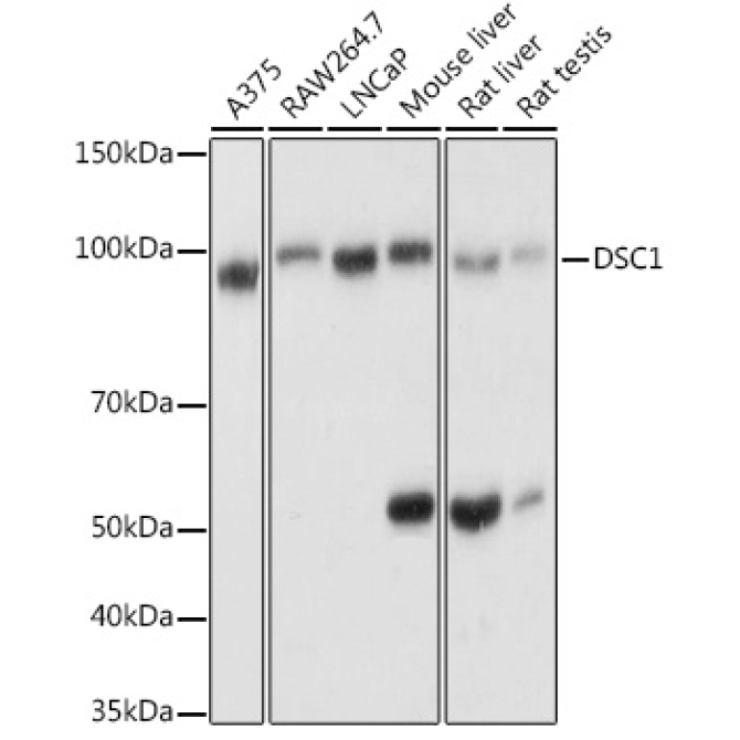 DSC1 Rabbit Polyclonal Antibody