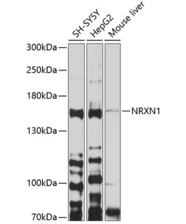 NRXN1 Rabbit Polyclonal Antibody
