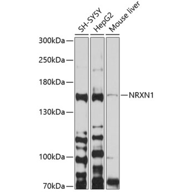 NRXN1 Rabbit Polyclonal Antibody