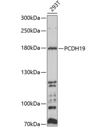 PCDH19 Rabbit Polyclonal Antibody