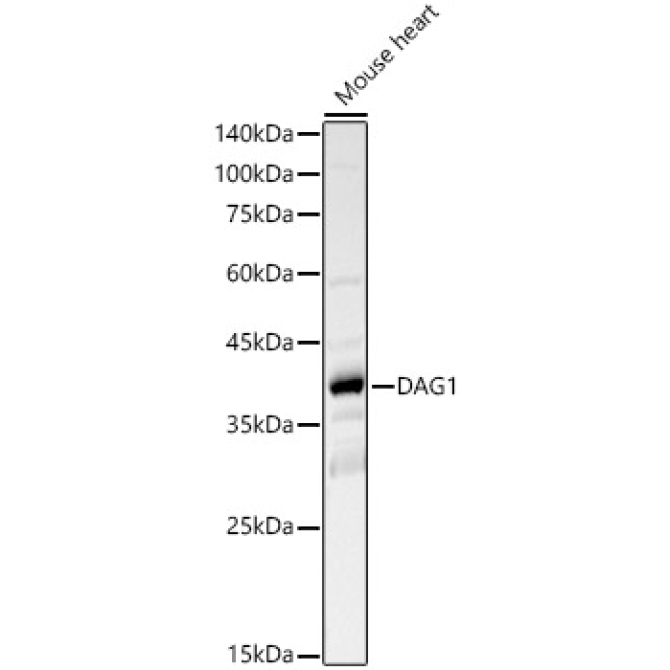 DAG1 Rabbit Polyclonal Antibody