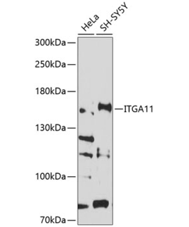 ITGA11 Rabbit Polyclonal Antibody